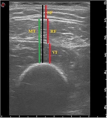 Muscle Ultrasound as Imaging Domain of Frailty